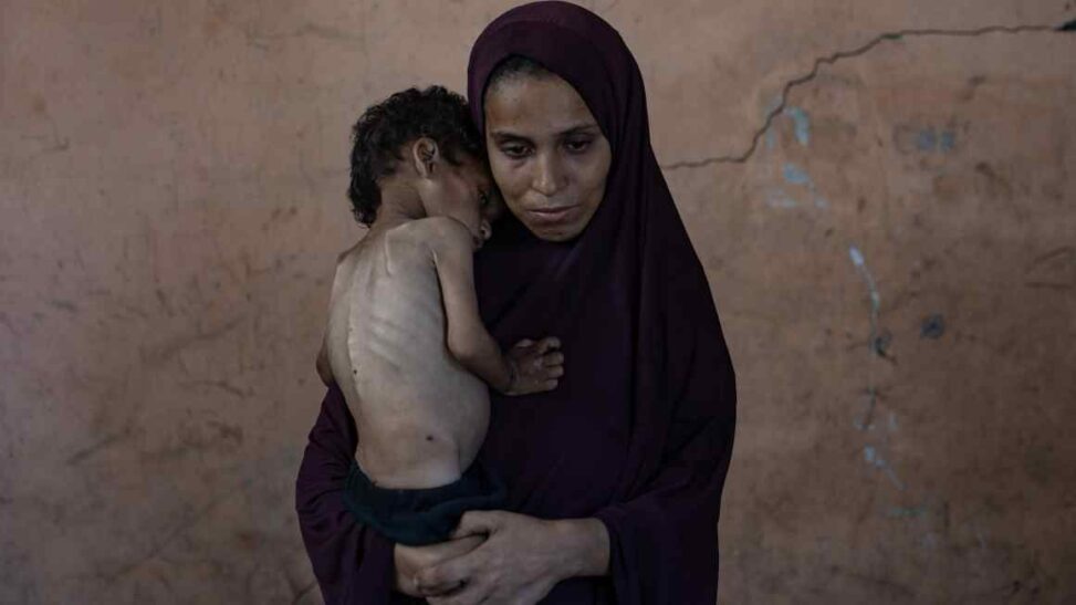 Doctors and health officials report wave of hunger deaths in gaza