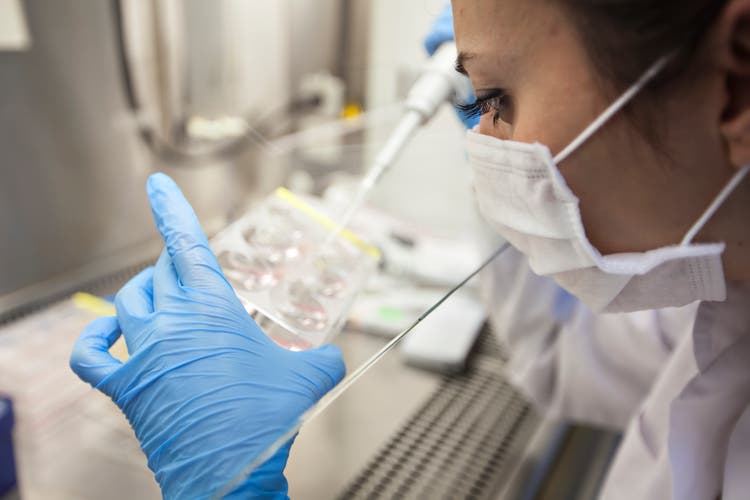 Quest diagnostics to offer fujirebio alzheimer's diagnostic test