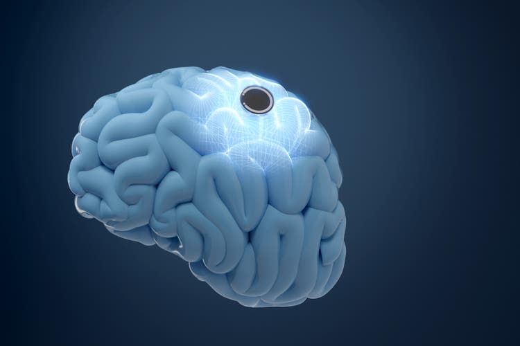Neuralink eyes $1b annual revenue by 2031 report