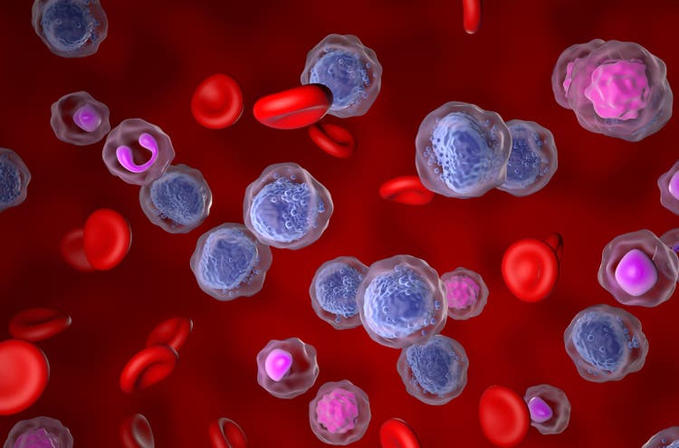 Sellas gains as mid stage trial for leukemia drug succeeds
