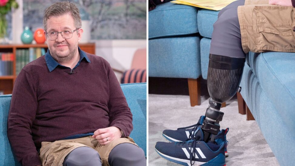 Surgeon charged with buying 'eunuch maker' videos and fraud over removal of own legs