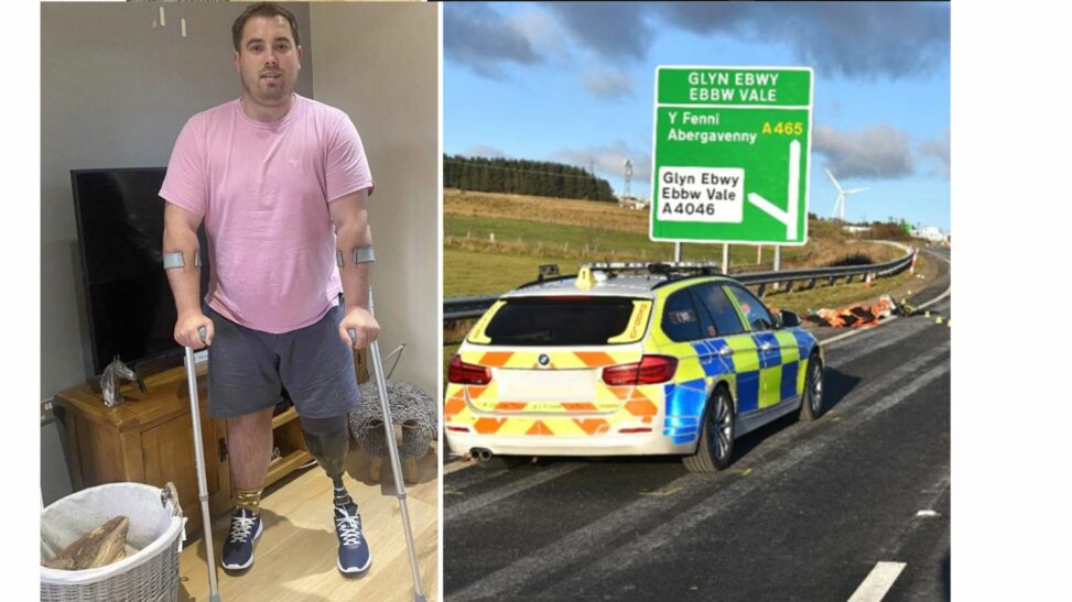 Man who had leg amputated after hit and run describes 'agony' of 'phantom pain'