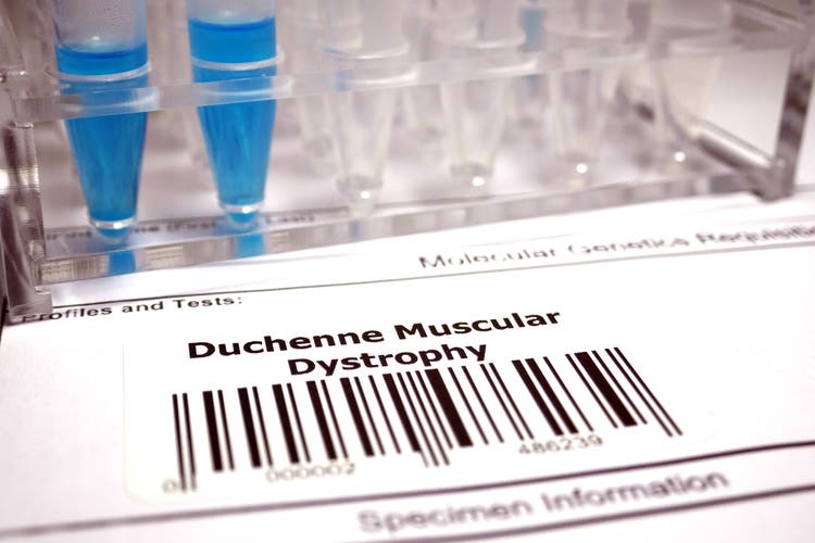 Dyne gets fda breakthrough therapy status for dmd therapy