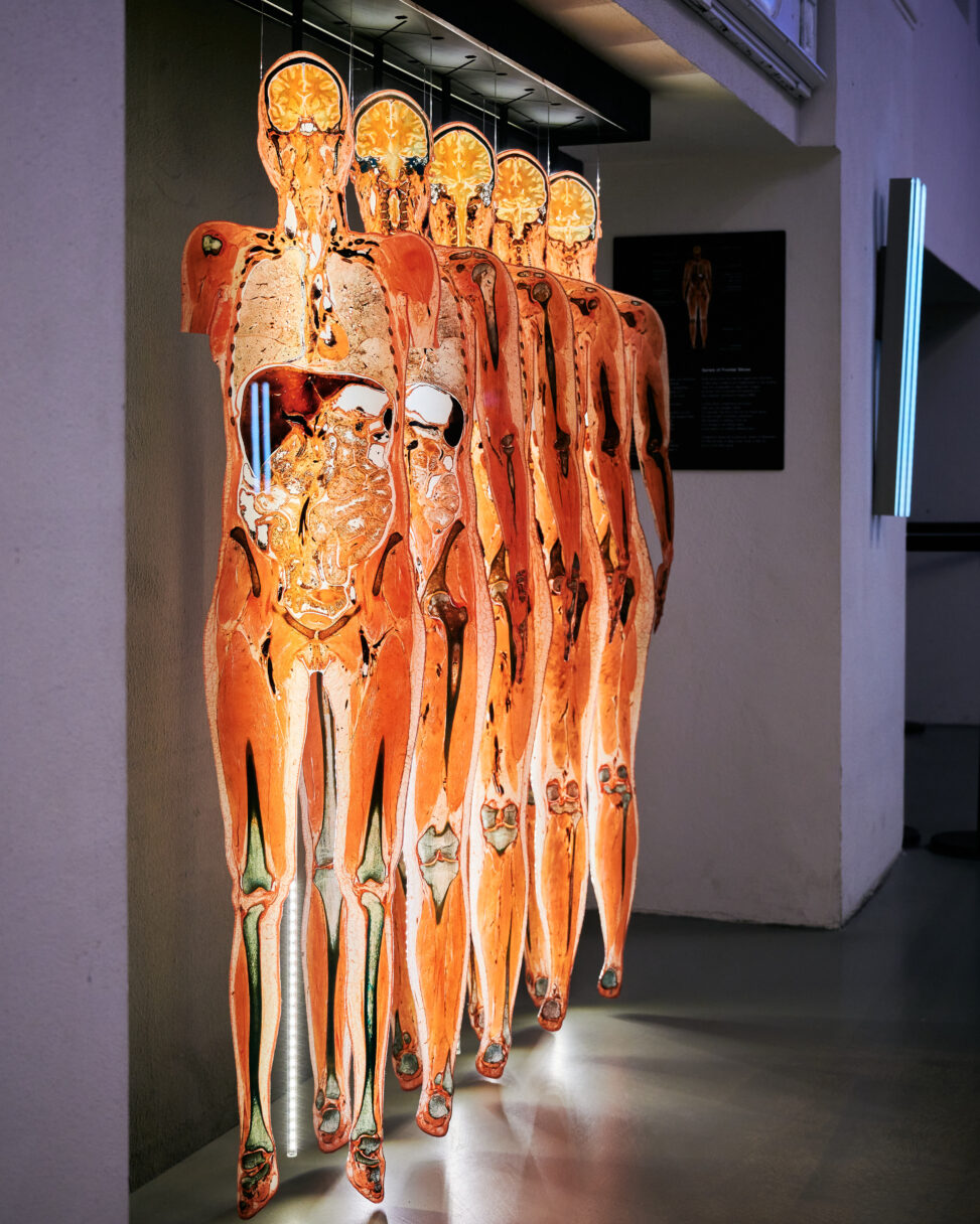 30 years of body worlds a success story that has changed the way we see ourselves