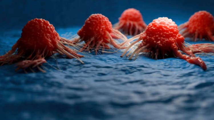Amgen dips after trial update for zai lab partnered gastric cancer therapy