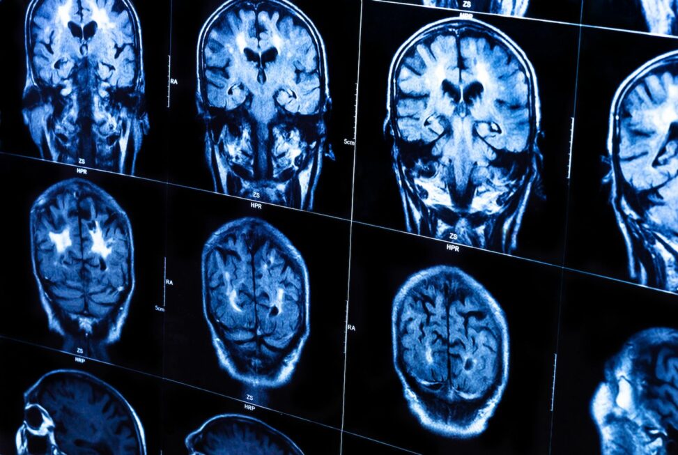How your brain may drive bitcoin higher